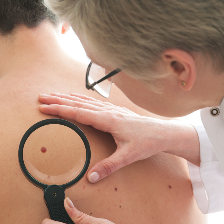 Skin Care Awareness Month: Why Early Detection and Non-Invasive Treatments Matter